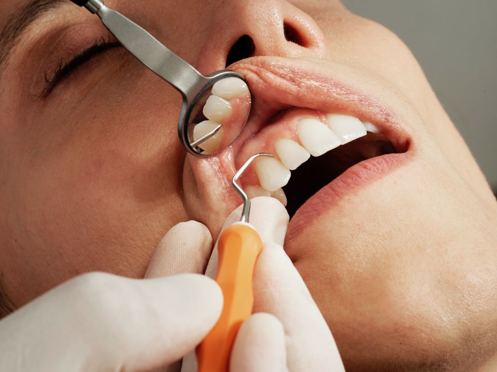 Genomskinlig tandställning - en diskret lösning för räta tänder