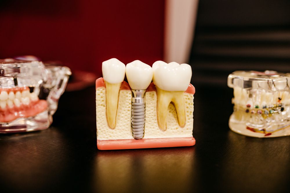Att Värdera Muntlig Hälsa: Vikten av Din Tandläkare