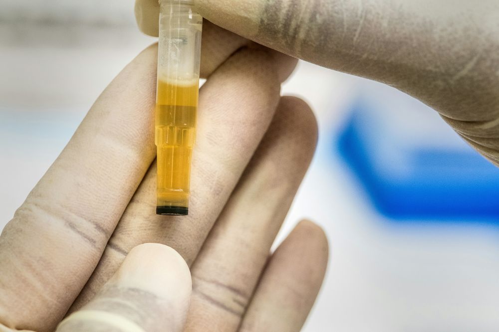 Blåscancer  symtom, diagnos och vägen vidare